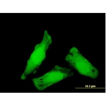 Monoclonal Anti-NIPBL antibody produced in mouse，100UG，WH0025836M1-100UG，Sigma