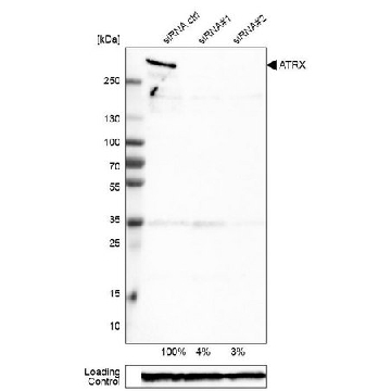 Monoclonal Anti-ATRX antibody produced in mouse，100UL，AMAB90784-100UL，Sigma