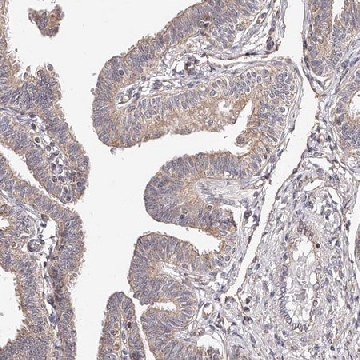Anti-USP21 antibody produced in rabbit，100UL，HPA028397-100UL，Sigma