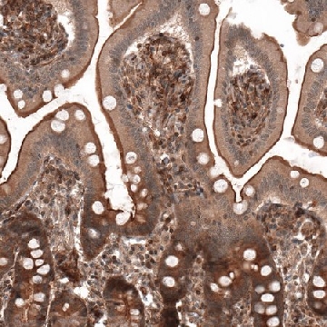 Anti-IL17RE antibody produced in rabbit，100UL，HPA019011-100UL，Sigma