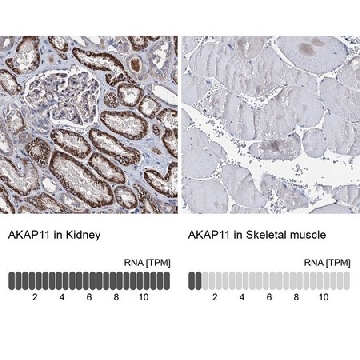 Anti-AKAP11 antibody produced in rabbit，100UL，HPA039089-100UL，Sigma
