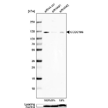 Anti-CCDC186 antibody produced in rabbit，100UL，HPA018019-100UL，Sigma