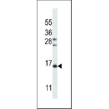 ANTI-FSHB/FSH (CENTER) antibody produced in rabbit，400UL，SAB1304978-400UL，Sigma