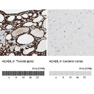 Anti-ACADL antibody produced in rabbit，100UL，HPA011990-100UL，Sigma