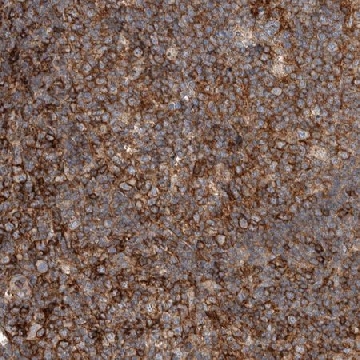 Anti-UGCG antibody produced in rabbit，100UL，HPA024124-100UL，Sigma