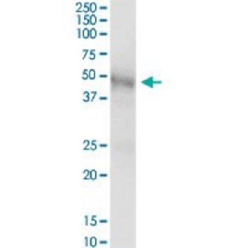 Anti-GLA antibody produced in mouse，50UG，SAB1405872-50UG，Sigma