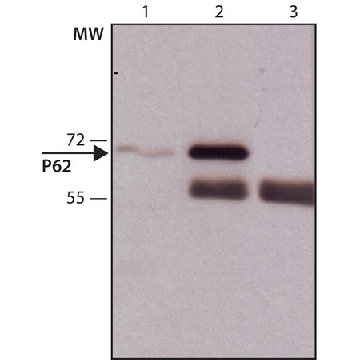 抗p62/SQSTM1 兔抗，200UL，P0067-200UL，Sigma