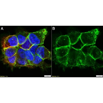 Anti-ITGA3 Antibody, clone P1B5 ZooMAb® Mouse Monoclonal，25UL，ZMS1168-25UL，Sigma