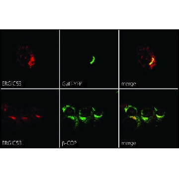 抗ERGIC-53/p58 兔抗，200UL，E1031-200UL，Sigma