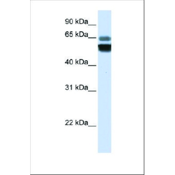 抗-SMPD1 兔抗，100UL，SAB2102244-100UL，Sigma