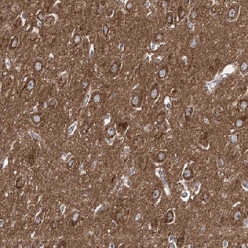 Anti-ADCY2 antibody produced in rabbit，100UL，HPA038015-100UL，Sigma