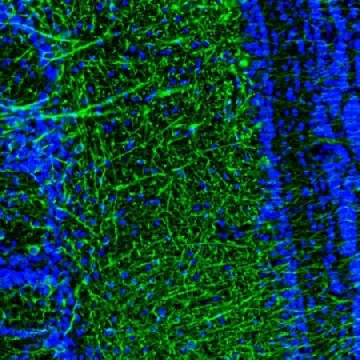 Anti-DPP6 antibody produced in rabbit，100UL，HPA050509-100UL，Sigma
