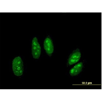 Anti-ADARB1 antibody produced in mouse，50UG，SAB1405426-50UG，Sigma