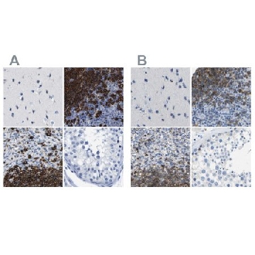 Anti-MS4A1 antibody produced in rabbit，100UL，HPA014341-100UL，Sigma