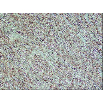 Anti-TDP-43 (C-terminal) antibody produced in rabbit，200UL，T1580-200UL，Sigma