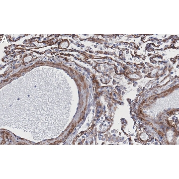 Anti-Elastin Antibody, clone 1G6 ZooMAb® Rabbit Monoclonal，4X25UL，ZRB1388-4X25UL，Sigma
