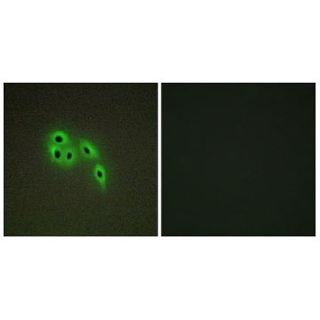 Anti-DOK6 antibody produced in rabbit，100UG，SAB4500865-100UG，Sigma