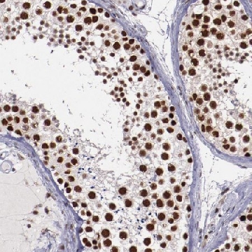 Anti-PPP4R3A antibody produced in rabbit，100UL，HPA002568-100UL，Sigma