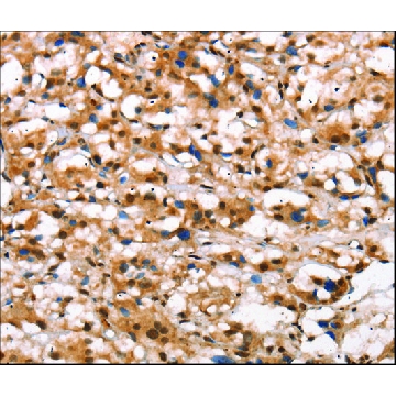 Anti-DGAT1 antibody produced in rabbit，100UL，SAB4301075-100UL，Sigma