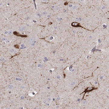 Anti-TAC1 antibody produced in rabbit，100UL，HPA014429-100UL，Sigma