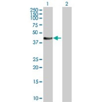 Anti-STYK1 antibody produced in rabbit，100UG，SAB1411055-100UG，Sigma