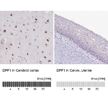 Anti-DPF1 antibody produced in rabbit，100UL，HPA049148-100UL，Sigma