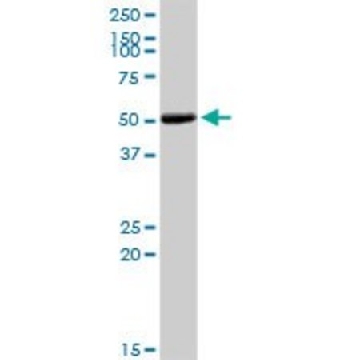 Anti-COL9A3 antibody produced in rabbit，100UG，SAB1410224-100UG，Sigma