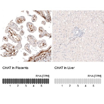 Monoclonal Anti-CHAT antibody produced in mouse，100UL，AMAB91129-100UL，Sigma