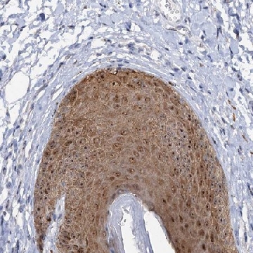 Anti-C2CD3 antibody produced in rabbit，100UL，HPA038553-100UL，Sigma