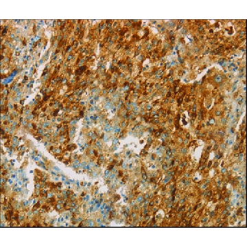 Anti-CEACAM8 antibody produced in rabbit，100UL，SAB4301144-100UL，Sigma
