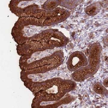 Anti-DDX19B antibody produced in rabbit，100UL，HPA046380-100UL，Sigma
