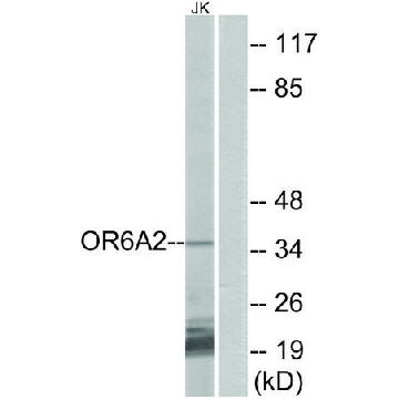 Anti-OR6A2 antibody produced in rabbit，100UG，SAB4503428-100UG，Sigma