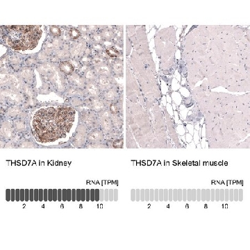 单克隆抗-THSD7A 小鼠抗，100UL，AMAB91234-100UL，Sigma