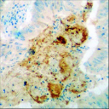 Anti-phospho-PP2A-α (pTyr³⁰⁷) antibody produced in rabbit，100UG，SAB4503975-100UG，Sigma