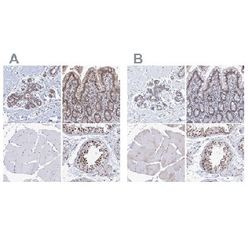 Anti-SF3B6 antibody produced in rabbit，100UL，HPA034830-100UL，Sigma