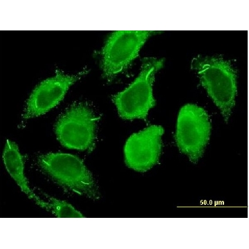 Monoclonal Anti-CALM2 antibody produced in mouse，100UG，WH0000805M1-100UG，Sigma