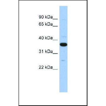 抗  MYD88 兔抗，100UL，SAB2104398-100UL，Sigma