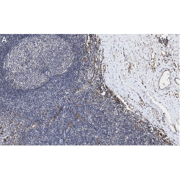Anti-CD31 Antibody, clone 4E20 , ZooMAb® Rabbit Monoclonal，4X25UL，ZRB1216-4X25UL，Sigma