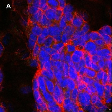 Anti-phospho-TrkB (Tyr816) Antibody, clone 2C21 ZooMAb® Rabbit Monoclonal，4X25UL，ZRB1495-4X25UL，Sigma