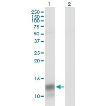 Monoclonal Anti-PF4 antibody produced in mouse，100UG，WH0005196M1-100UG，Sigma