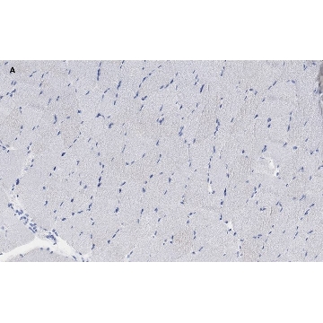 Anti-alpha Actinin 2 Antibody, clone 1E11, ZooMAb® Rabbit Monoclonal，25UL，ZRB1169-25UL，Sigma