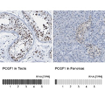 Anti-PCGF1 antibody produced in rabbit，100UL，HPA011356-100UL，Sigma