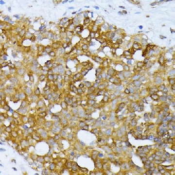 Anti-ATG7 antibody produced in rabbit，100UL，SAB5700649-100UL，Sigma