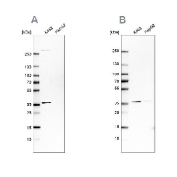 Anti-OTUD6B antibody produced in rabbit，100UL，HPA024046-100UL，Sigma
