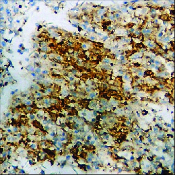 Anti-phospho-PKC-pan (pThr⁴⁹⁷) antibody produced in rabbit，100UG，SAB4504099-100UG，Sigma