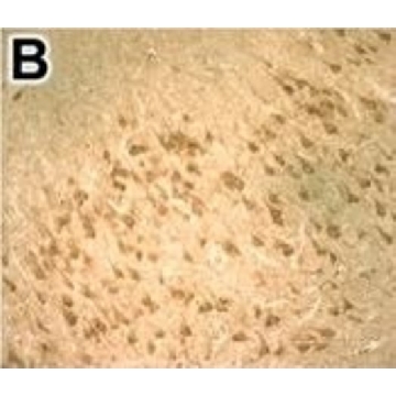 Anti-DNMT1 antibody produced in rabbit，100UL，HPA002694-100UL，Sigma