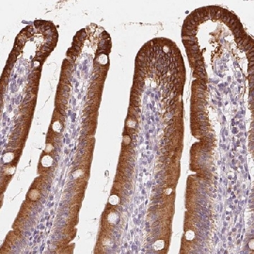 Anti-TMSB15B antibody produced in rabbit，100UL，HPA064607-100UL，Sigma