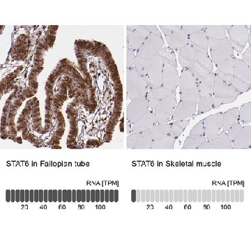 Anti-STAT6 antibody produced in rabbit，100UL，HPA001861-100UL，Sigma