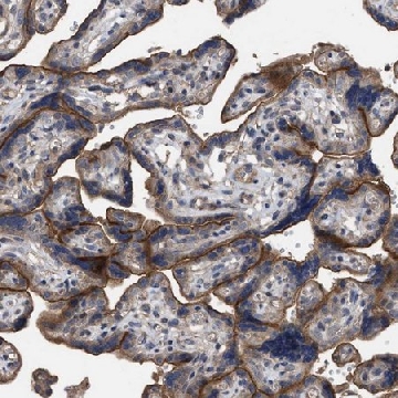 Anti-BTN2A1 antibody produced in rabbit，100UL，HPA019208-100UL，Sigma