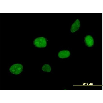 Anti-APEX2 antibody produced in mouse，50UG，SAB1400507-50UG，Sigma